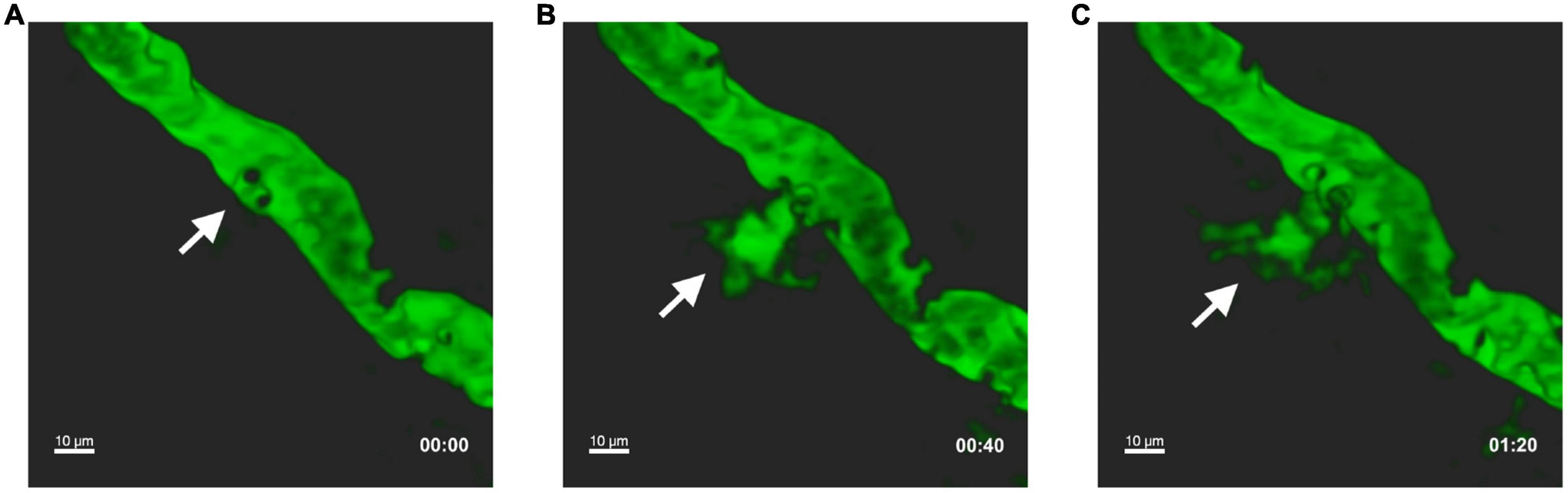 The interplay between T helper cells and brain barriers in the pathogenesis of multiple sclerosis